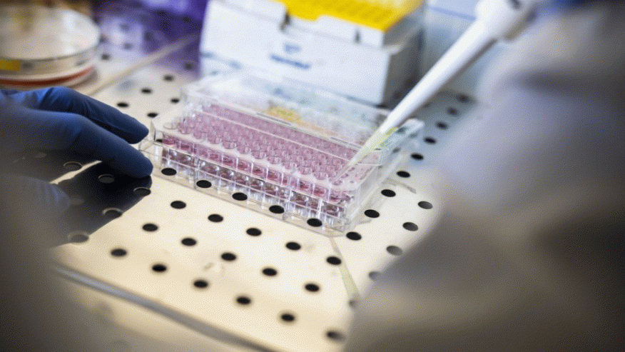 An&aacute;lises ao sangue altamente precisas v&atilde;o revolucionar diagn&oacute;sticos de Alzheimer